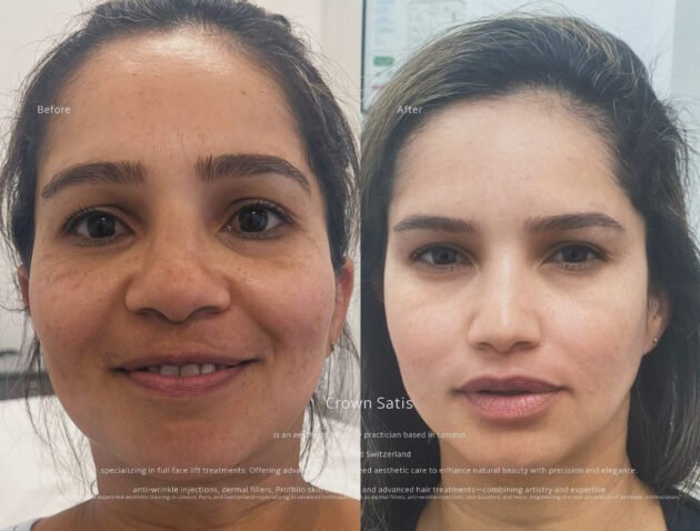 Full Face Transformation – Reveal Your Most Radiant Self - Image 3
