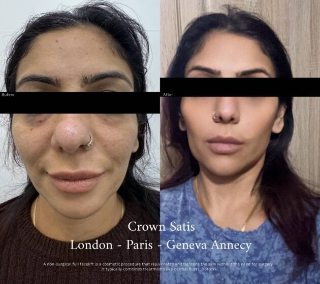 Full Face Transformation – Reveal Your Most Radiant Self - Image 2