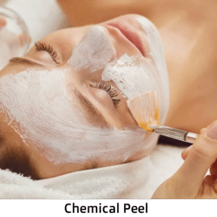 Transform Your Skin with Professional Peeling Therapy